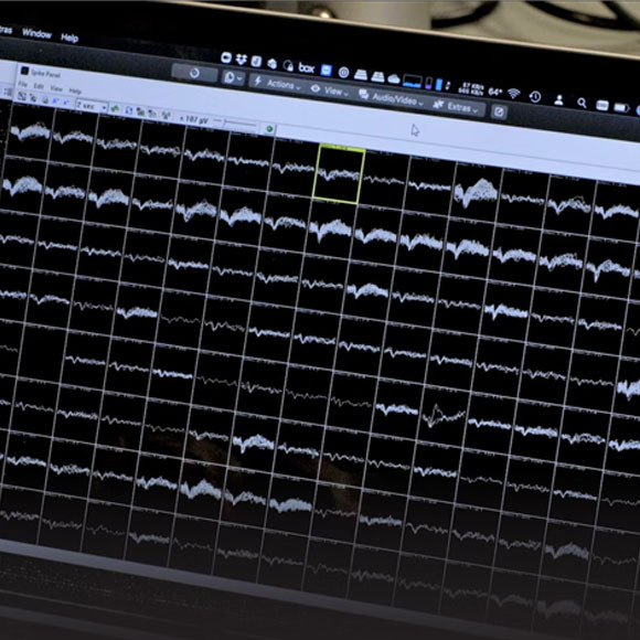 הפעילות של תאי עצב שונים, כפי שהיא מוצגת במחשב | Wyss Center
