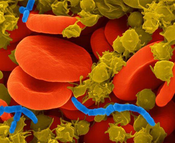 זיהום חיידקי בדם (כחול), הרעלת דם | Dennis Kunkel Microscopy, Science Photo Library