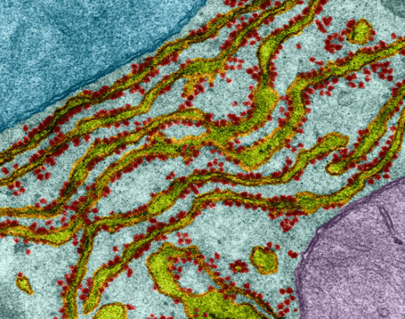 צילום מיקרוסקופ אלקטרונים צבוע של הרשתית התוך-פלזמית, בירוק-צהוב, והריבוזומים שעליה באדום | Dennis Kunkel Microscopy, Science Photo Library