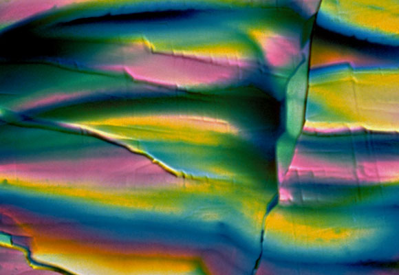 بلّورات من الإنسولين - الهرمون الّذي يدفع الخلايا إلى امتصاص السّكّر من الدّم - التُقِطَت بعدسة مجهر ضوئيّ | المصدر: Science Photo library