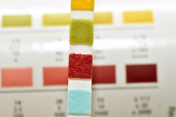 وريقة لقياس السّكّر في البول |  تصوير: Science Photo library