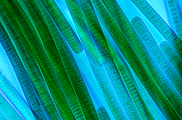 بكتيريا زرقاء من النوع Oscillatoria. التصوير بواسطة المجهر: MAREK MIS / SCIENCE PHOTO LIBRARY