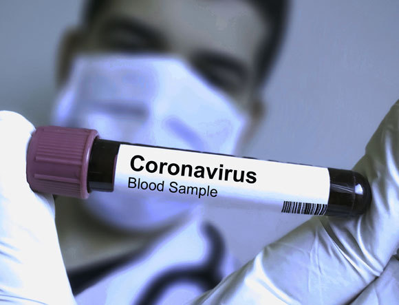 מבחנה עם דם נגוע | אילוסטרציה: Soni&#39;s, Shutterstock