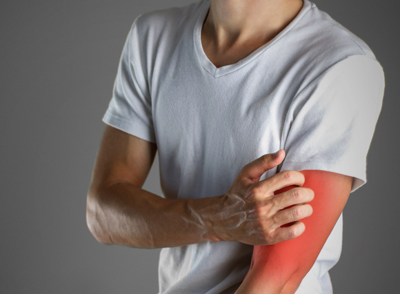 בחור מתגרד בחוזקה | צילום: OBprod, Shutterstock