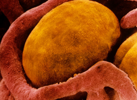 ,צילום מיקרוסקופ אלקטרונים של תא שומן חום | Prof S. Cinti, SPL