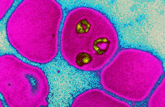 הטפיל פלסמודיום פלציפרום, הגורם למחלת המלריה | James Cavallini, SPL