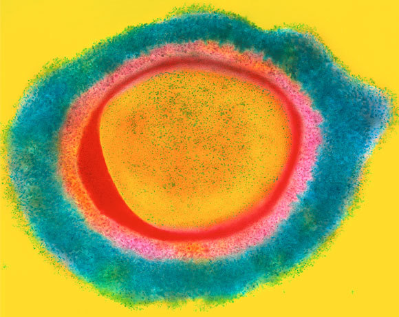 צילום במיקרוסקופ אלקטרונים של חיידק סטפילוקוקוס עמידים לאנטיביוטיקה | צילום: DR KARI LOUNATMAA / SCIENCE PHOTO LIBRARY