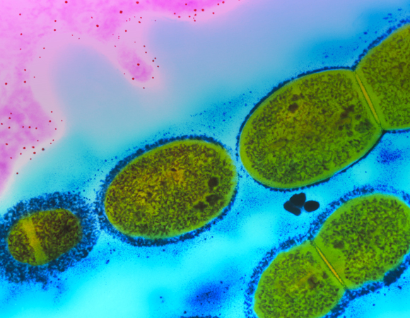 רעלנים שגורמים להפעלה הרסנית של מערכת החיסון. חיידקי סטרפטוקוקוס פיוגנס | צילום: Science Photo Library