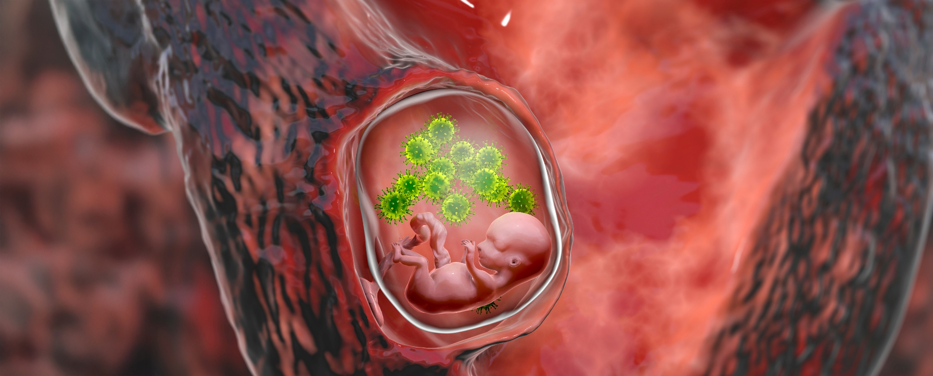 גילוי ישראלי: מנגנון שמפחית את הסכנה לעובר בהיריון