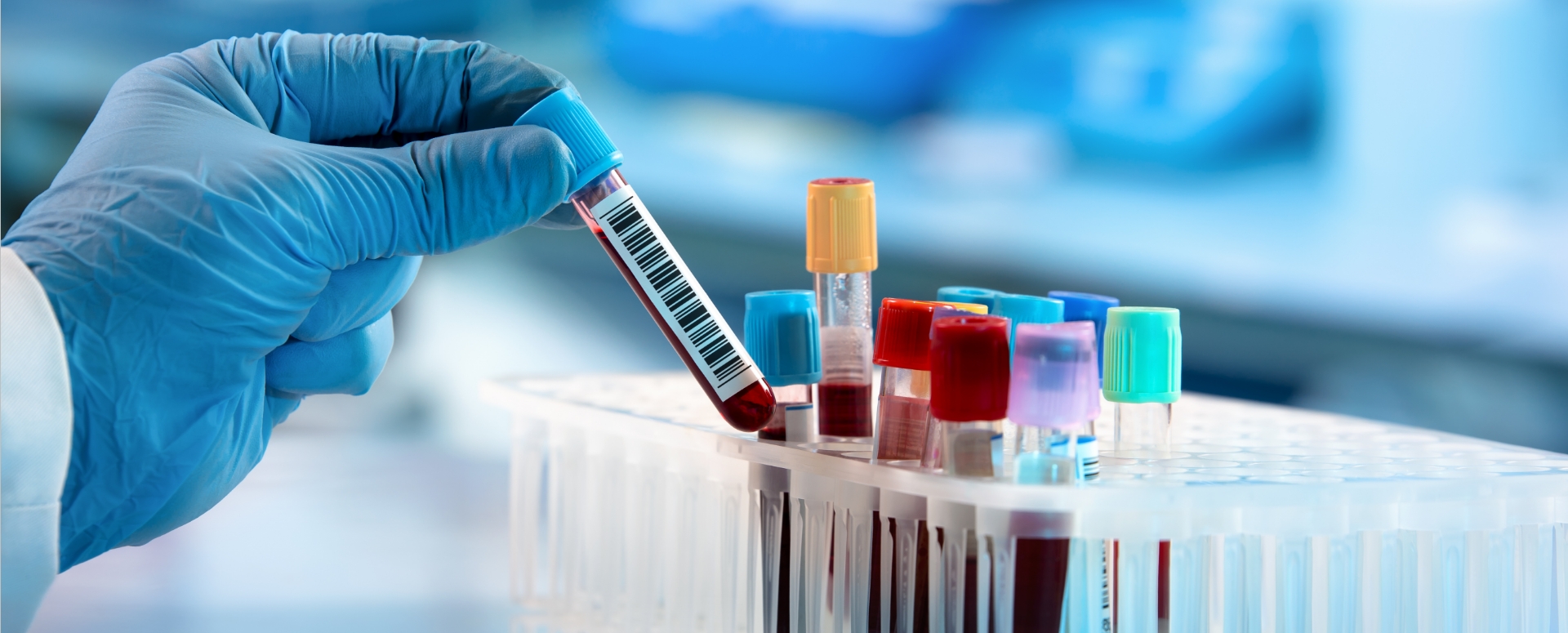 מחלות ללא גבולות: עלייה בתחלואת השפעת