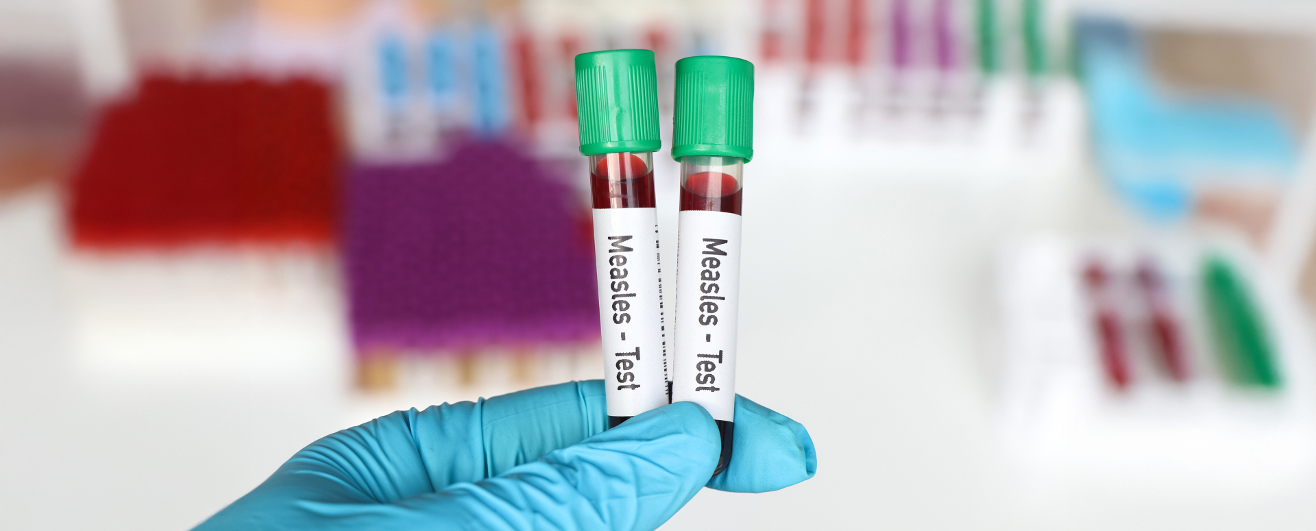 מחלות ללא גבולות: חצבת כאן, חצבת שם