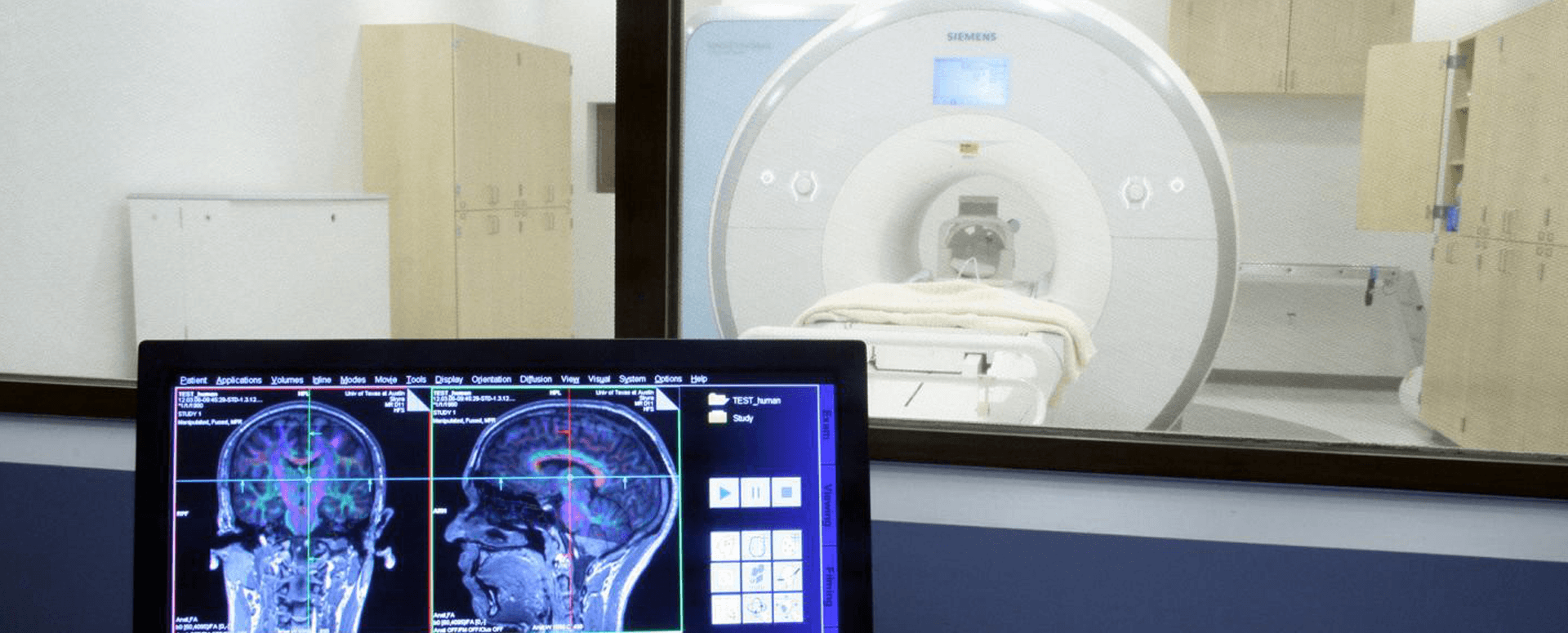 אופס, טעינו: הפרשנות של עשרות אלפי מחקרי הדמיה מוטלת בספק